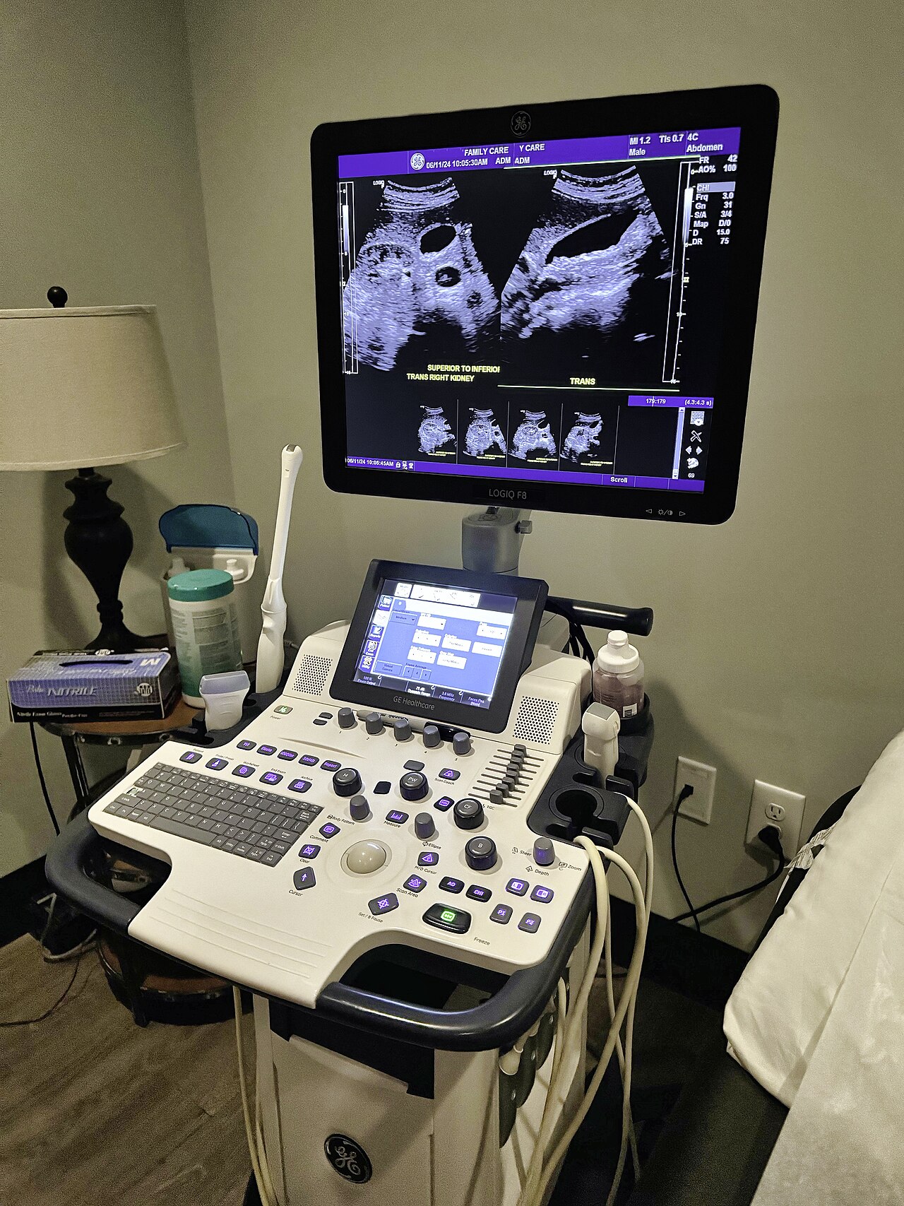 portable ultrasound system used at the bedside in a clinic