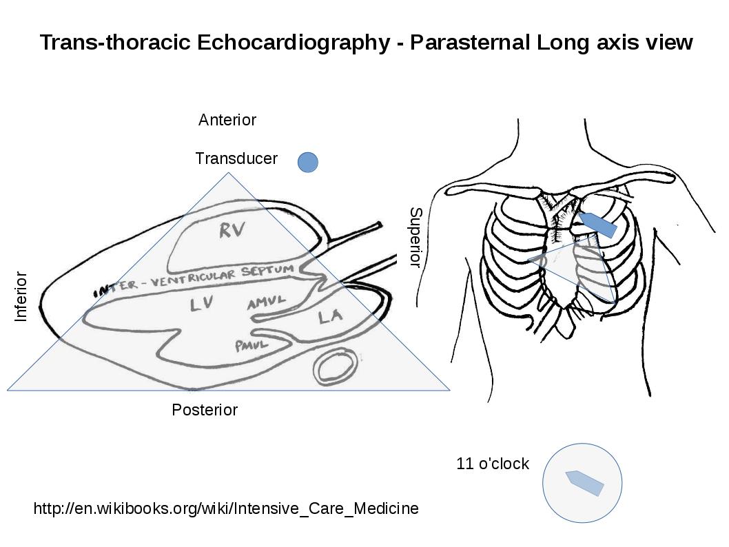 parasternal long axis echocardiography view of the heart