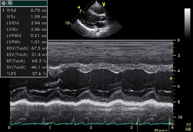 parasternal long axis M-mode echocardiography tracing