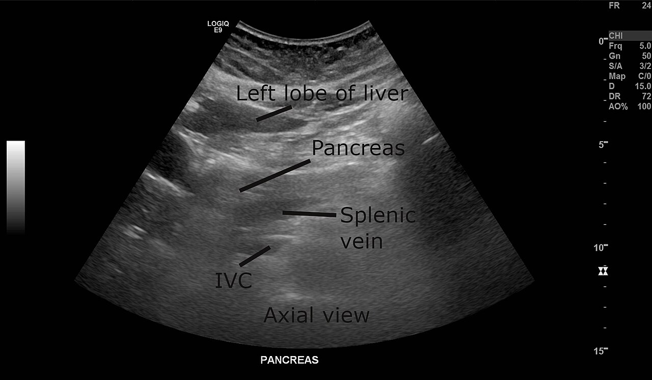 abdominal ultrasound scan