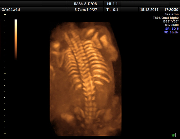 fetal ultrasound render