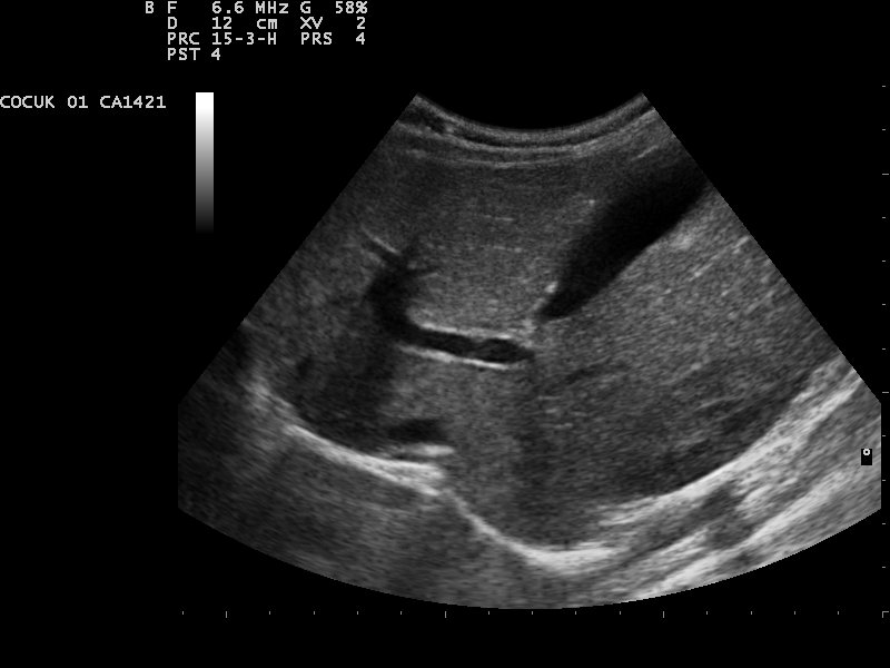 ultrasound scan image