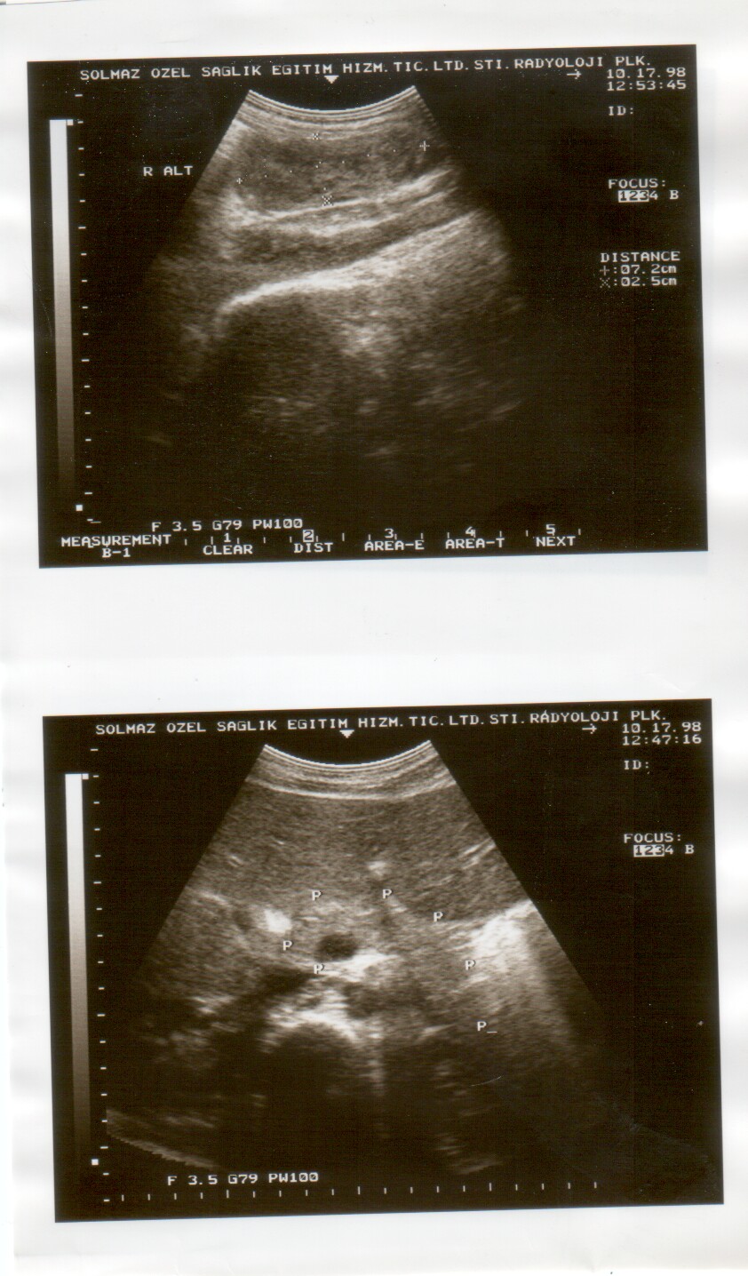ultrasound scan image