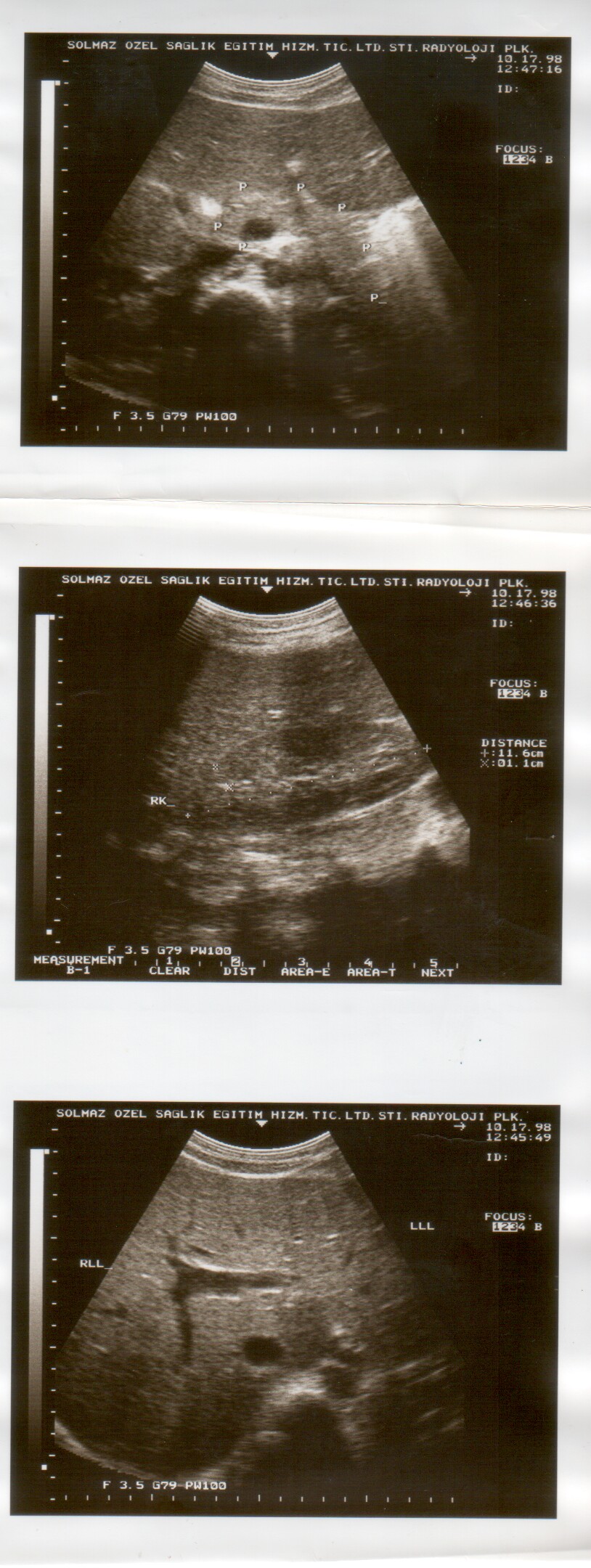 ultrasound scan image