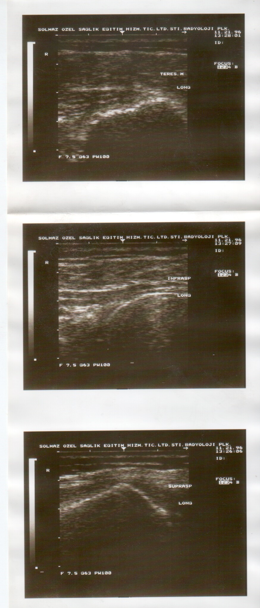ultrasound scan image