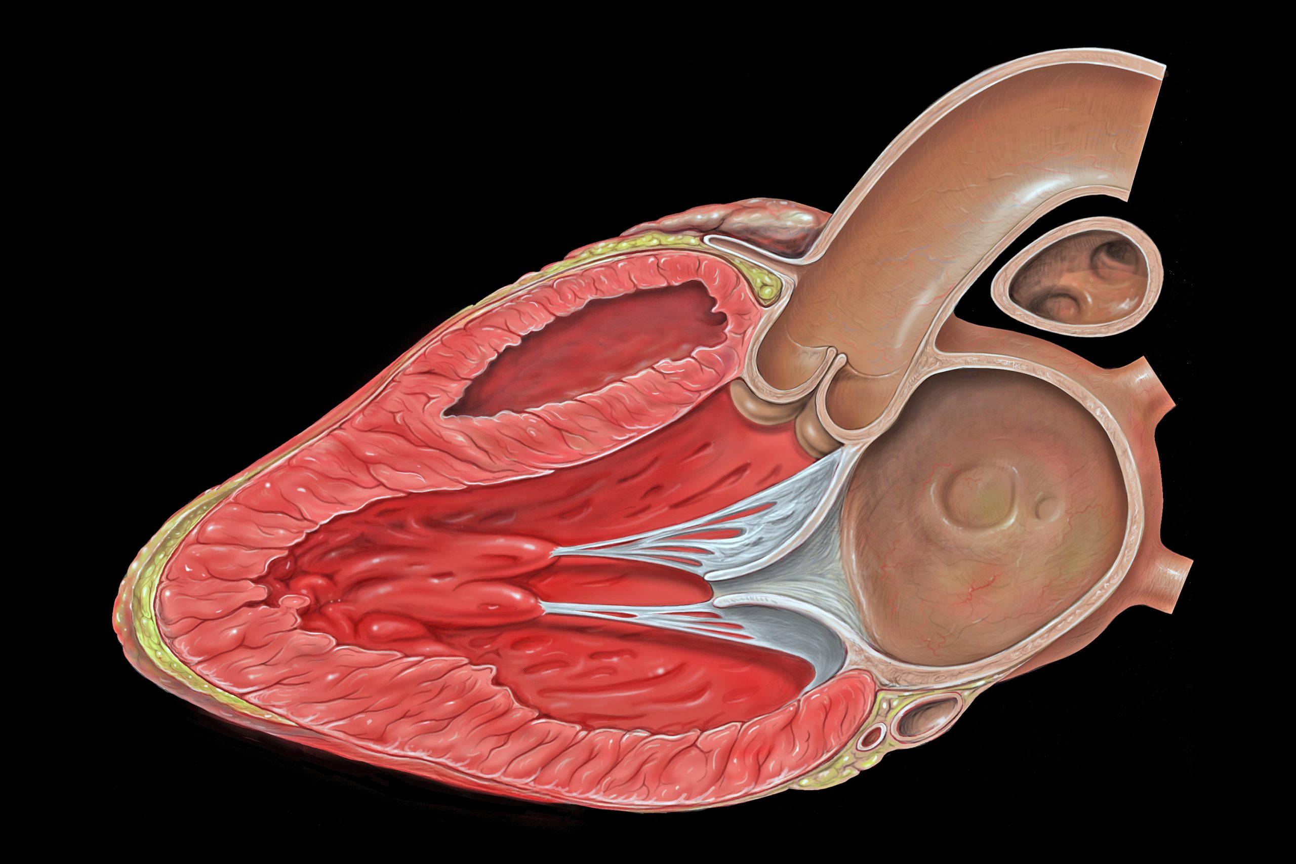 Parasternal long axis echocardiogram