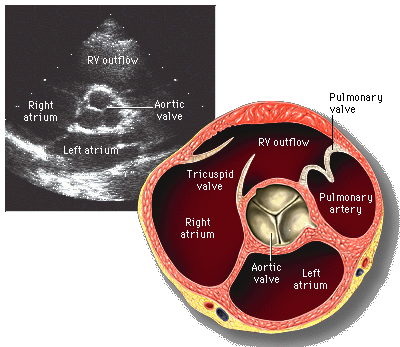 Parasternal short axis at the aortic valve