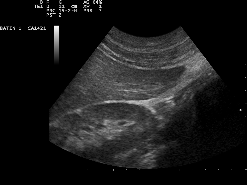 An ultrasound image streamed from a handheld probe to a tablet