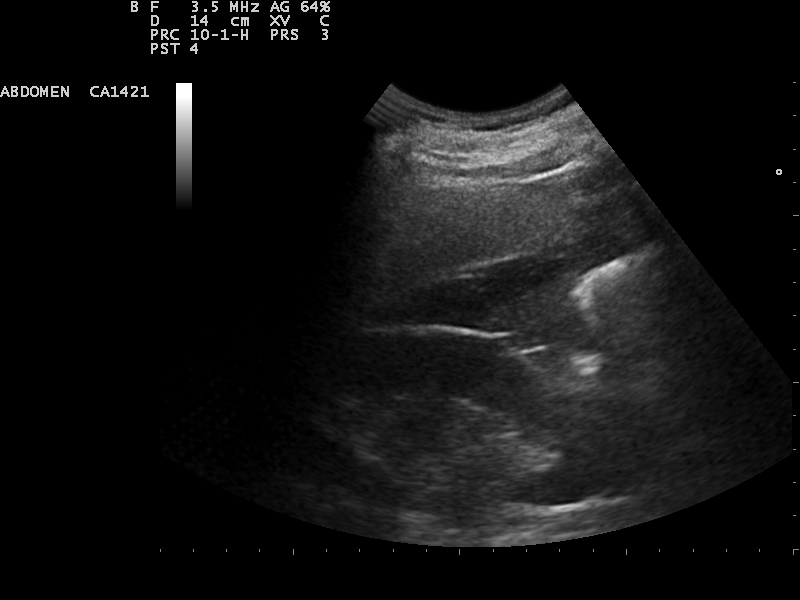A scan displayed on the connected tablet screen