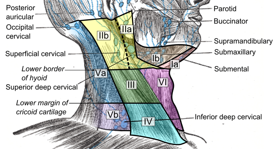 Schematic of the cervical lymph node levels one to six of the neck