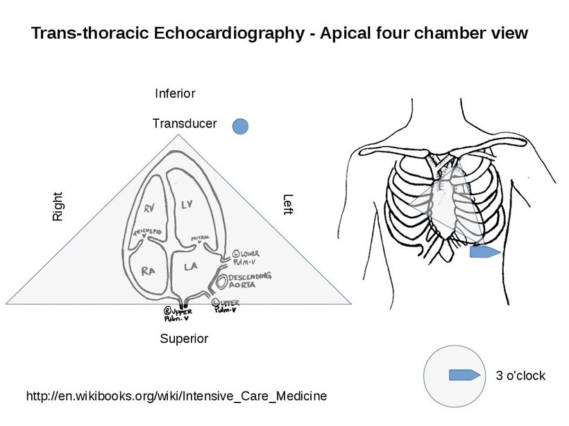 A diagram of the apical four-chamber view showing transducer position, the four heart chambers and the beam orientation on the chest.