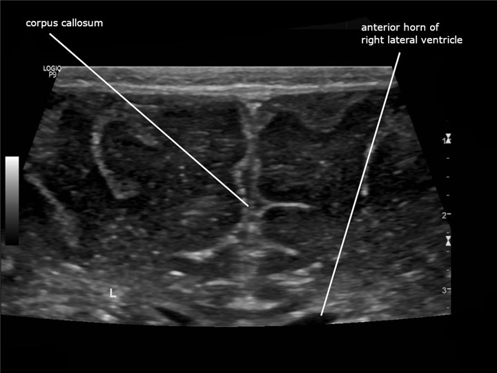 A high-frequency ultrasound image showing fine detail of shallow structures.