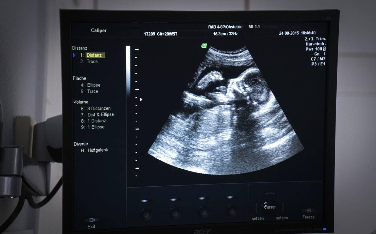 Twenty-week obstetric anomaly scan on the ultrasound machine