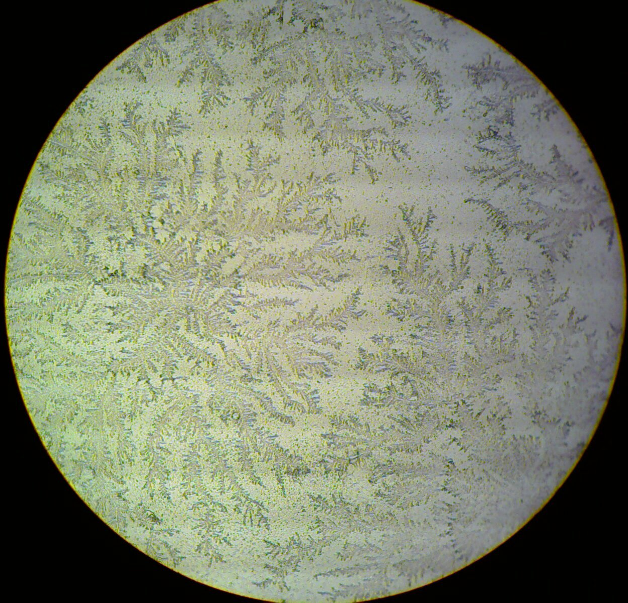 Positive fern test, the branching crystal pattern of dried amniotic fluid