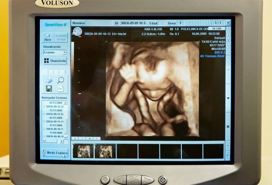 A 3D rendered keepsake image of a fetus on an ultrasound scanner screen
