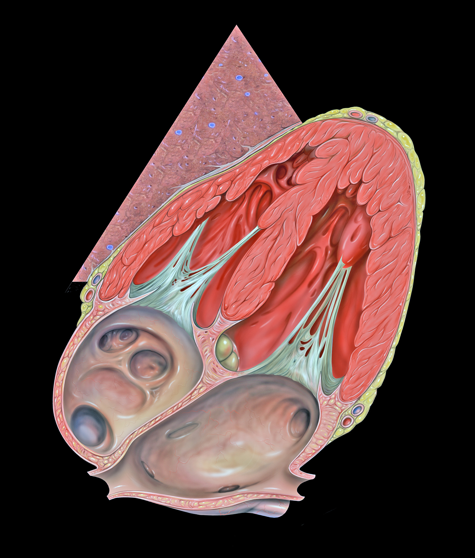 A cutaway drawing of the heart with the ultrasound beam shown as a pale wedge at the subcostal window.