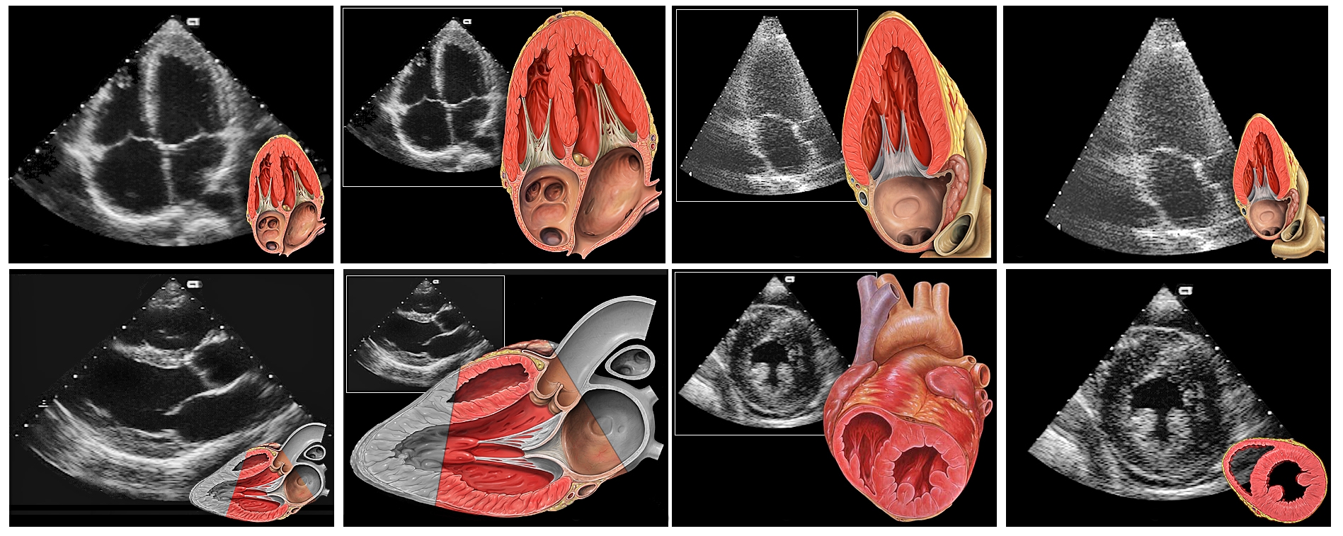 A montage of the standard transthoracic echo views, each ultrasound view beside a matching anatomical drawing of the heart.