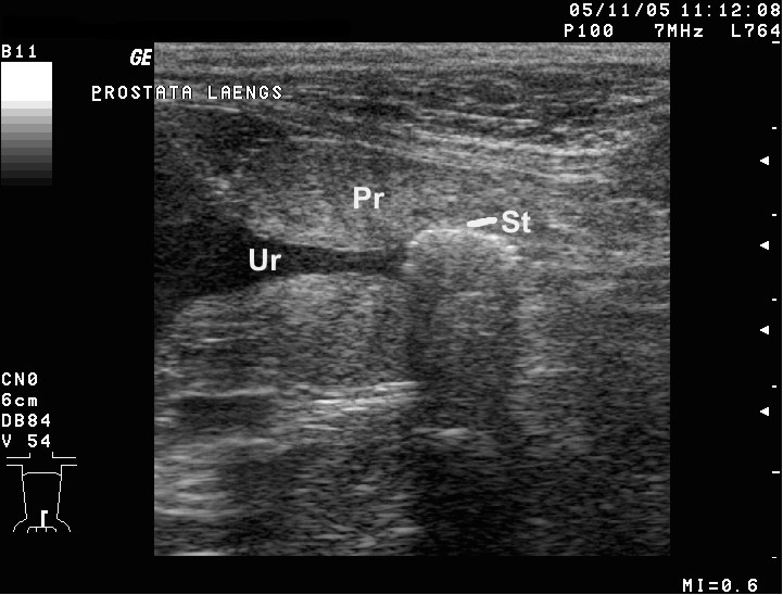 Ultrasound of a dog prostate and urethra with a stone labelled St casting an acoustic shadow.