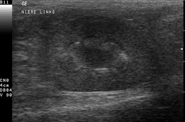B-mode ultrasound of a cat left kidney with chronic kidney disease, the cortex bright and layers blurred.