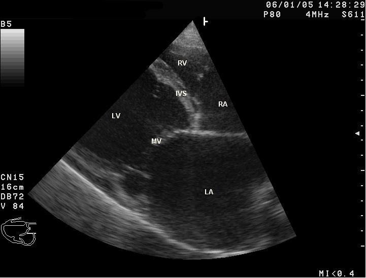 Dog heart ultrasound with the chambers labelled, the left ventricle and atrium enlarged.