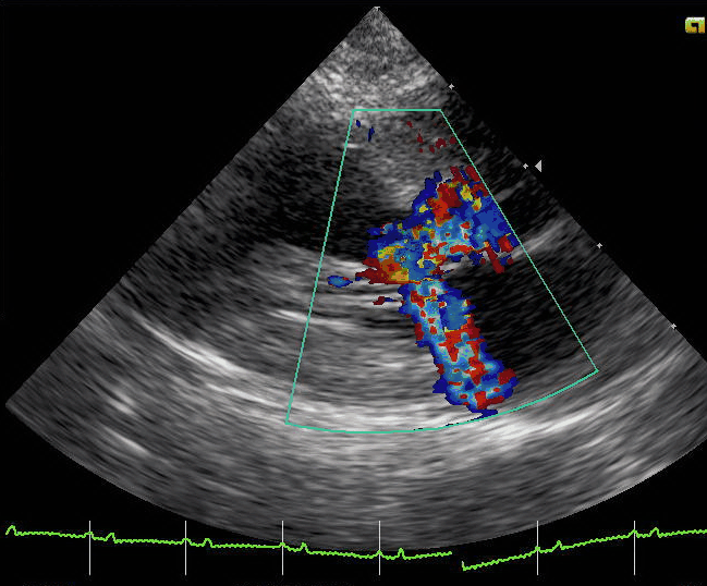 Colour-Doppler echocardiogram of a cat with obstructive hypertrophic cardiomyopathy, turbulent flow in the outflow.