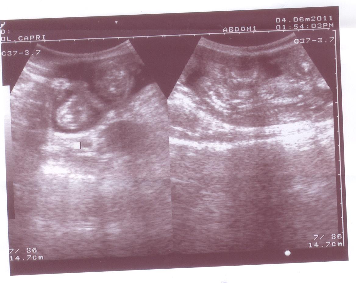 Canine pregnancy ultrasound at about forty days, a curled fetus visible inside its sac.