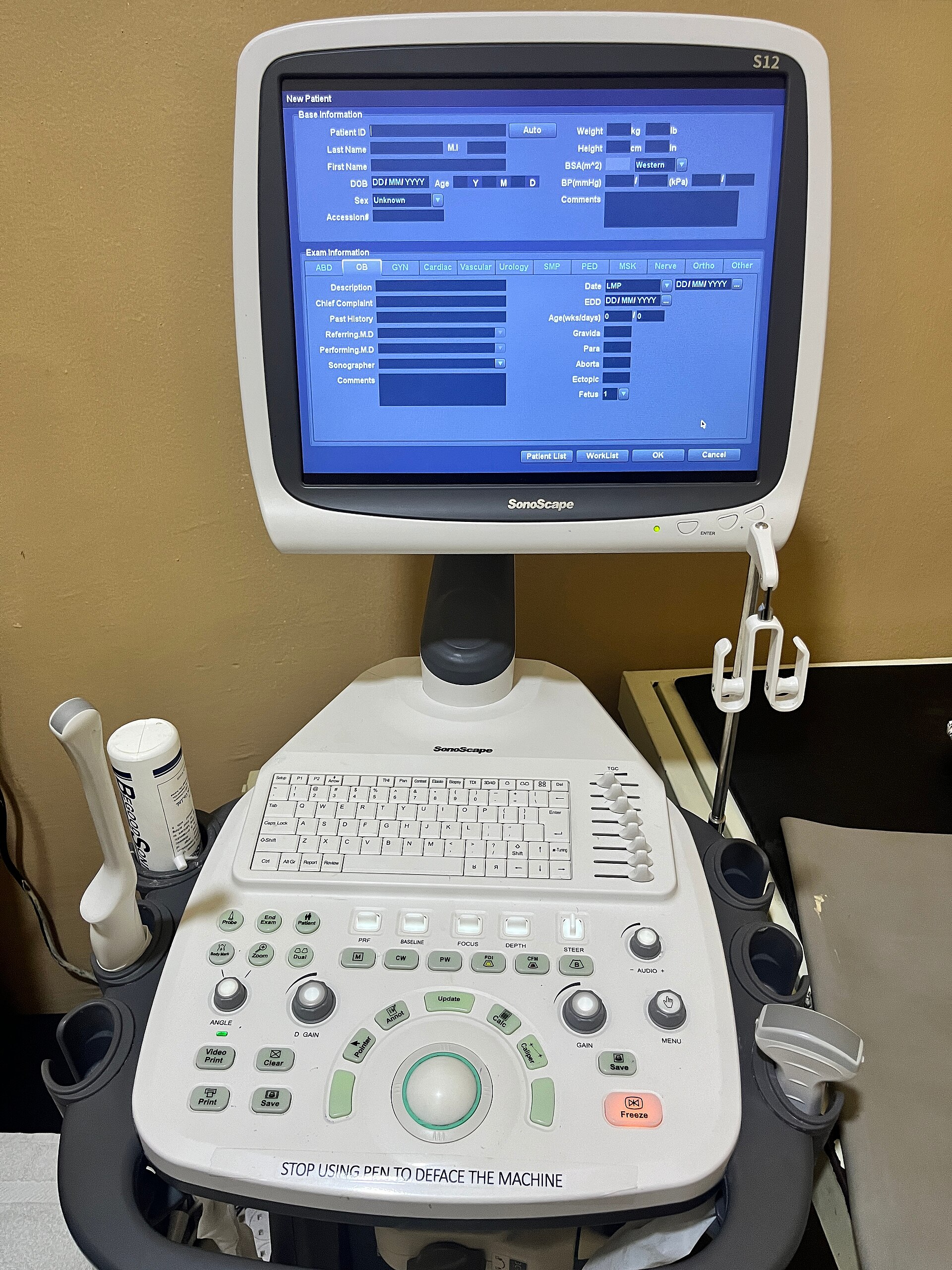 An ultrasound console with a screen, keyboard, control panel, and a probe in its holder.