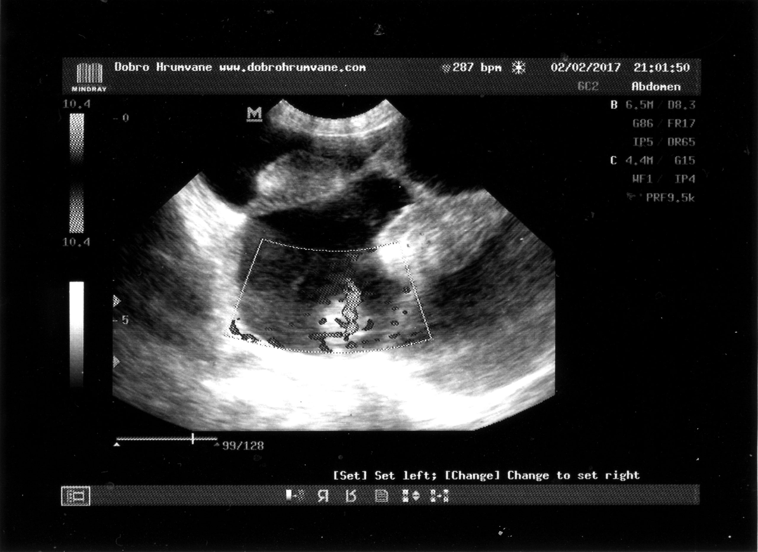 Colour-Doppler ultrasound of a pregnant roe deer with a fetal heart-rate readout of 287 beats per minute.