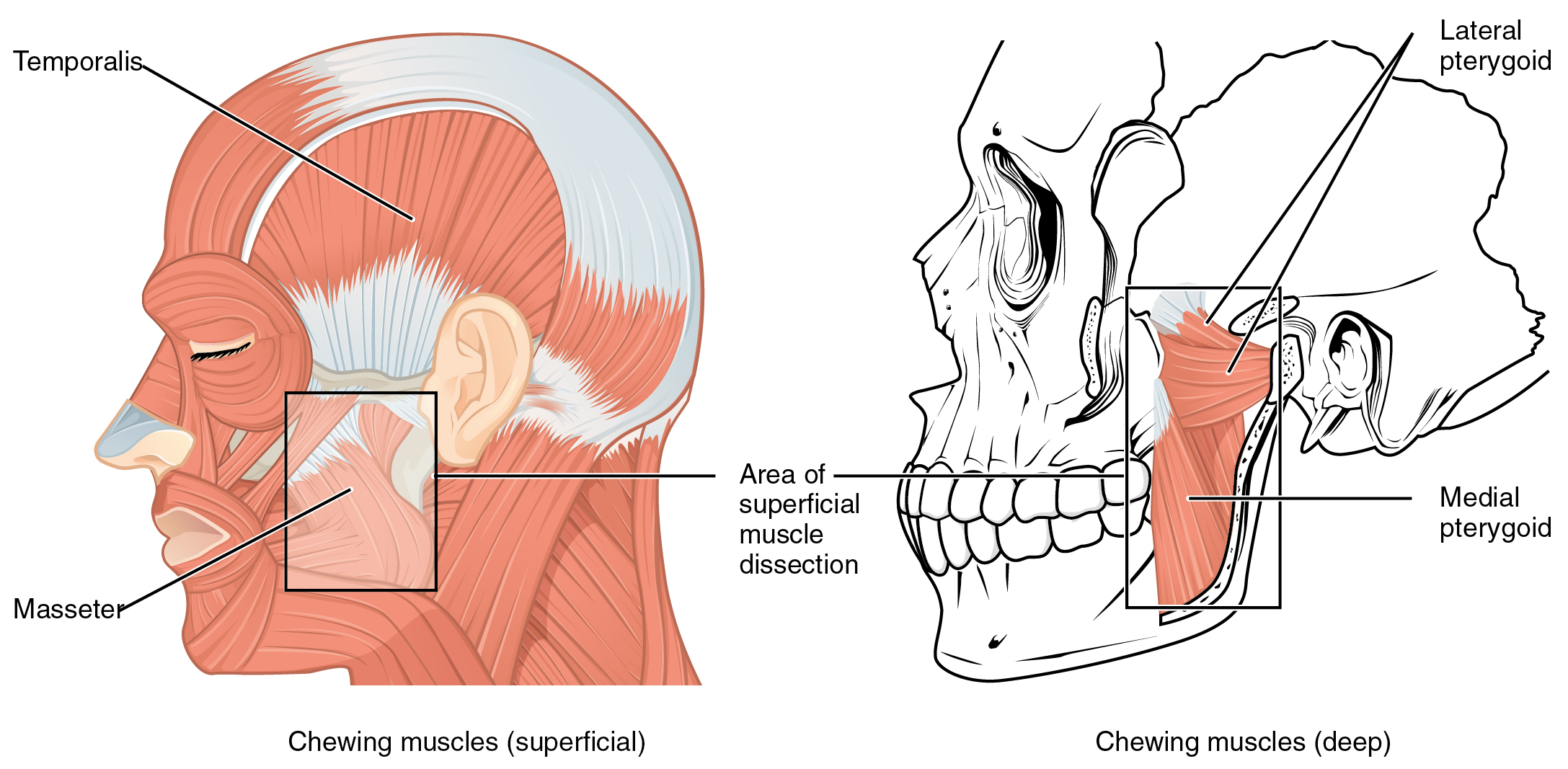 Anatomical diagram of the chewing muscles: masseter, temporalis and pterygoids