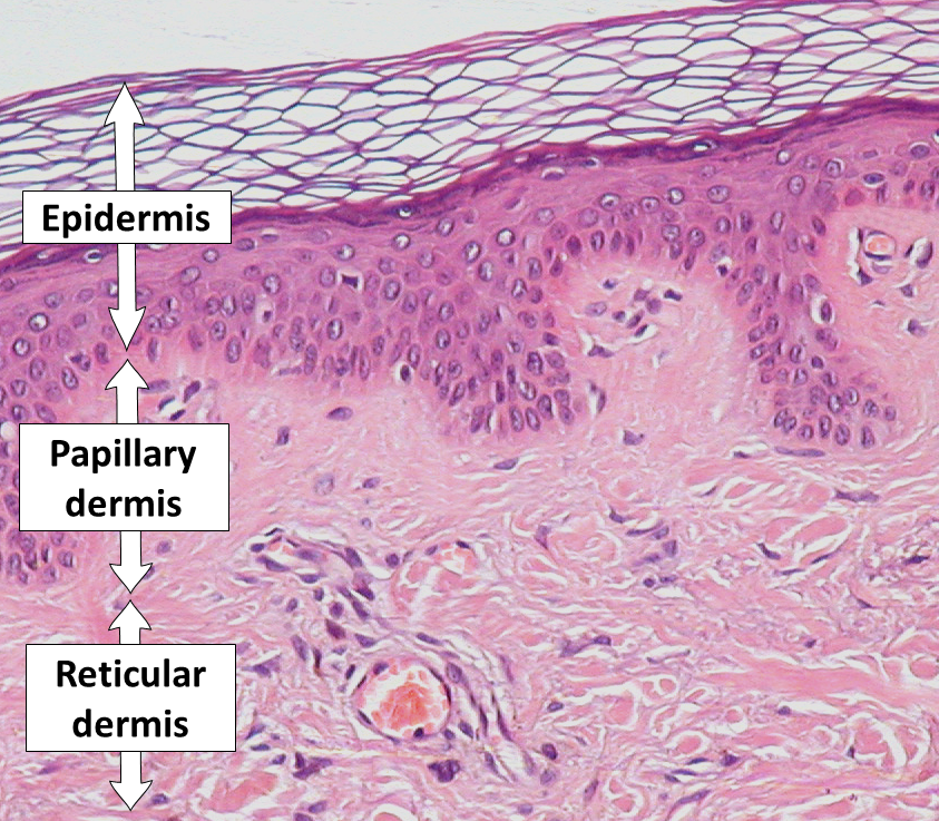Histology of skin showing the epidermis, papillary dermis and reticular dermis