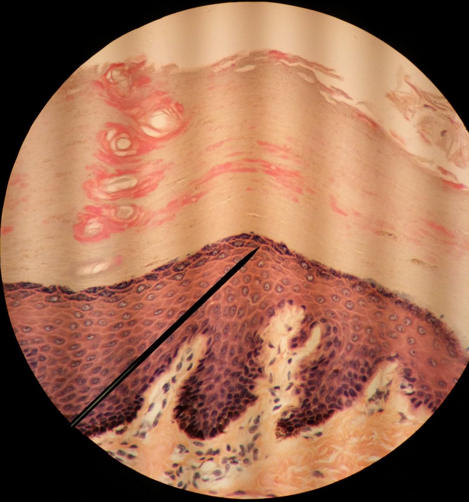 Histology of thick skin showing the keratin layer, the epidermis and the dermis