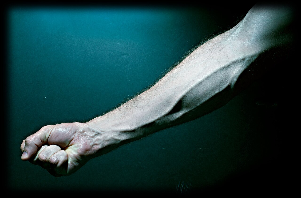Surface veins standing out on a forearm and the back of a hand