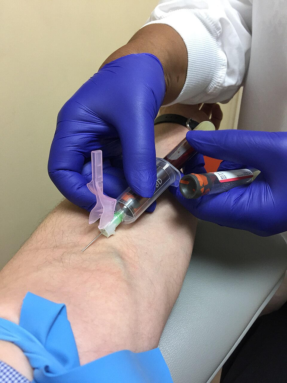 A gloved clinician drawing blood from a forearm vein into collection tubes