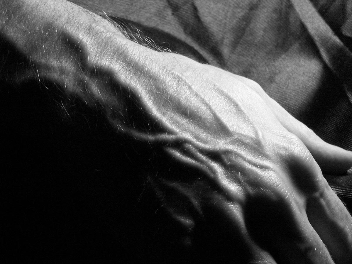 Surface veins standing out on the back of a hand