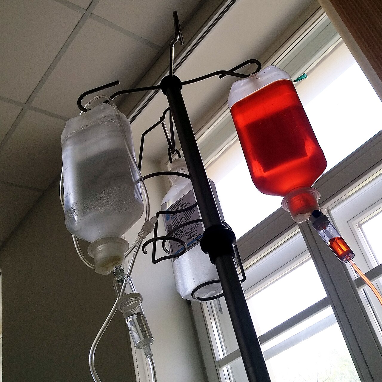Bags of chemotherapy drugs hanging on an infusion pole, one of them bright red