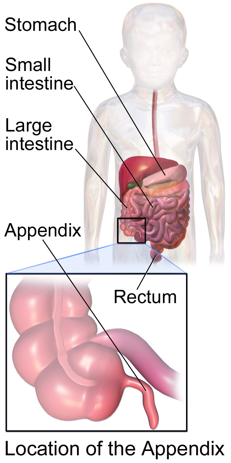 Diagram of a child showing the appendix at the base of the cecum where the large intestine begins